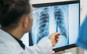 Doctor looks at lung X-ray