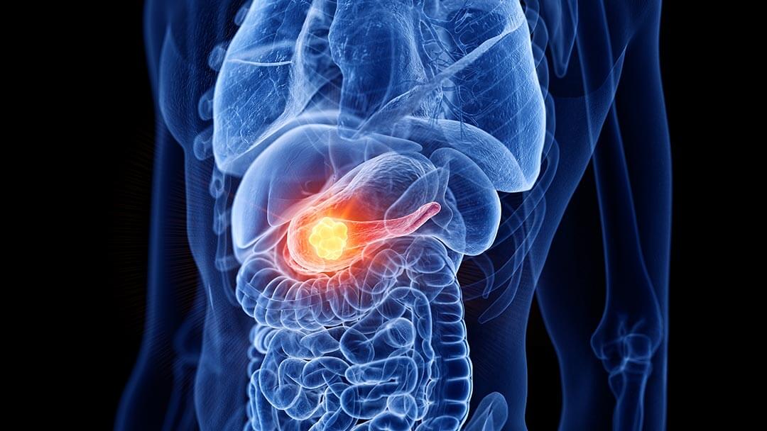 A Promising Pancreatic Cancer Discovery | Science@UH Podcast ...