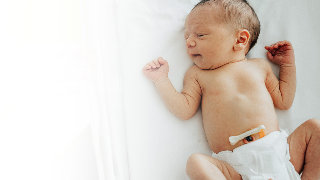 Caring for Your Baby's Umbilical Cord Area