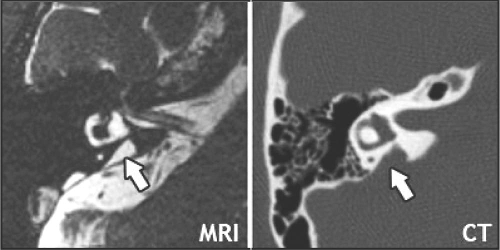 MRI and CT images courtesy of the National Institutes of Health, Department of Health and Human Services