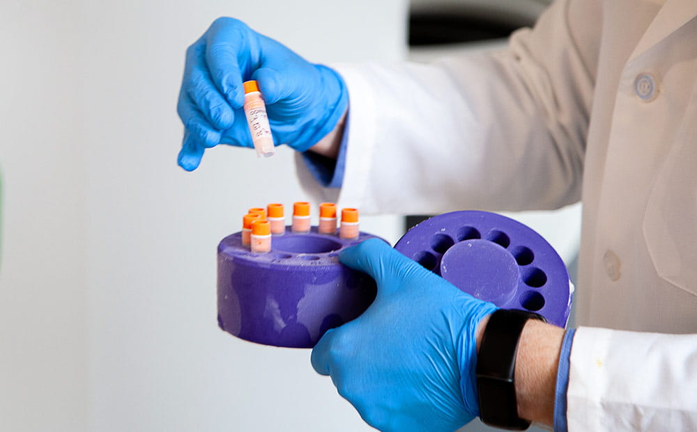 A cancer researcher holds a carousel of vials